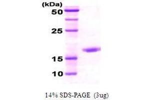 Figure annotation denotes ug of protein loaded and % gel used. (DnaK (AA 508-638) Peptid)