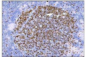 IHC analysis of Ki67 using anti-Ki67 antibody (ABIN7601100).