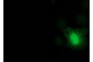 Anti-DCK mouse monoclonal antibody (ABIN2454431) immunofluorescent staining of COS7 cells transiently transfected by pCMV6-ENTRY DCK (RC210767). (DCK Antikörper)