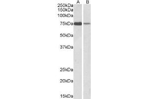 ABIN2564849 (1µg/ml) staining of K562 (A) and Jurkat (B) lysate (35µg protein in RIPA buffer). (RACGAP1 Antikörper  (C-Term))