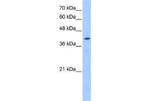 WB Suggested Anti-POMT2 Antibody Titration:  0. (POMT2 Antikörper  (Middle Region))