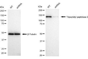 Western blotting analysis using Tripeptidyl peptidase 2 antibody (ABIN7800646).