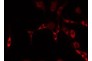 ABIN6274909 staining HeLa by IF/ICC. (B4GALNT1 Antikörper  (Internal Region))