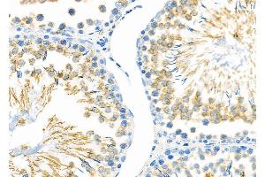 ABIN6257707 and ABIN6274332 at 1/100 staining Rat testis tissue by IHC-P. (CHAF1B Antikörper  (N-Term))