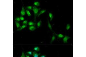 Immunofluorescence analysis of A549 cells using HEXIM1 Polyclonal Antibody (HEXIM1 Antikörper)