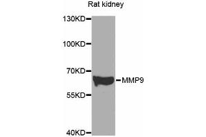 Western blot analysis of extracts of various cell lines, using MMP9 antibody (ABIN4904401) at 1:500 dilution. (MMP 9 Antikörper)