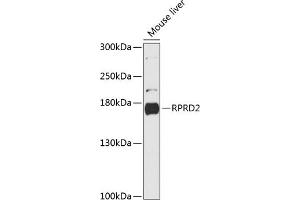 Western blot analysis of extracts of mouse liver, using RPRD2 antibody (ABIN6130674, ABIN6147187, ABIN6147188 and ABIN6216935) at 1:3000 dilution. (RPRD2 Antikörper  (AA 1-350))