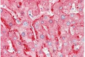 Human Liver: Formalin-Fixed, Paraffin-Embedded (FFPE)