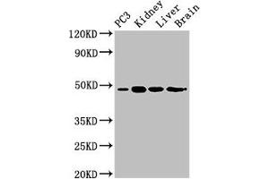 Western Blot Positive WB detected in: PC-3 whole cell lysate, Mouse kidney tissue, Mouse liver tissue, Rat brain tissue All lanes: ACP6 antibody at 3 μg/mL Secondary Goat polyclonal to rabbit IgG at 1/50000 dilution Predicted band size: 49, 31 kDa Observed band size: 49 kDa (ACP6 Antikörper  (AA 35-324))