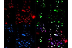 Immunofluorescence analysis of GFP-RNF168 transgenic U2OS cells using PIAS1 antibody (ABIN5973357).
