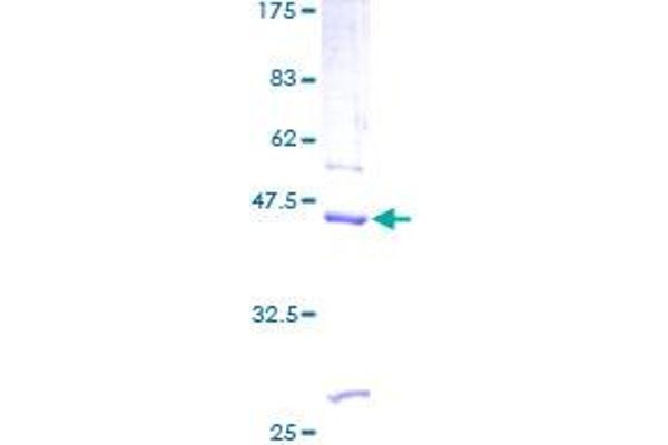 REG1B Protein (AA 1-166) (GST tag)