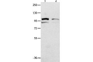 Western blot analysis of 231 cell  and mouse kidney tissue  , using MVP Polyclonal Antibody at dilution of 1:500 (MVP Antikörper)