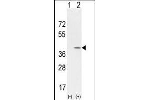 Western blot analysis of CCND1 (arrow) using rabbit polyclonal CCND1 Antibody (Center) (Cat.