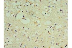 Immunohistochemistry of paraffin-embedded human brain tissue using ABIN7149475 at dilution of 1:100 (DRD3 Antikörper  (AA 213-329))