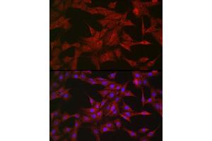 Immunofluorescence analysis of PC-12 cells using SOCS3 Rabbit pAb (ABIN3015316, ABIN3015317, ABIN5663764 and ABIN6213984) at dilution of 1:50 (40x lens). (SOCS3 Antikörper  (C-Term))