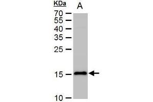 WB Image LC3B antibody detects LC3B protein by western blot analysis. (LC3B Antikörper)