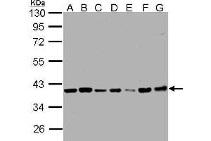 WB Image Sample (30μg whole cell lysate) A: 293T B: A431 , C: H1299 D: HeLa S3 , E: Hep G2 , F: MOLT4 , G: Raji , 7. (PPP1CB Antikörper  (Center))