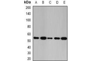Western blot analysis of Glutathione Synthetase expression in SW480 (A), K562 (B), Raji (C), mouse kidney (D), mouse liver (E) whole cell lysates. (Glutathione Synthetase Antikörper)