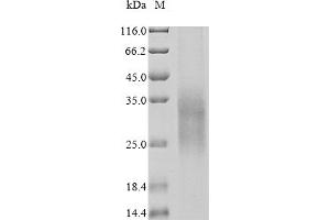 (Tris-Glycine gel) Discontinuous SDS-PAGE (reduced) with 5 % enrichment gel and 15 % separation gel.