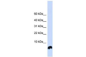 GLRX antibody used at 1 ug/ml to detect target protein. (Glutaredoxin 1 Antikörper)