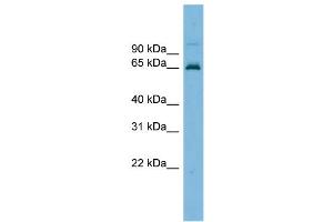 WB Suggested Anti-TRIM25 Antibody Titration: 0. (TRIM25 Antikörper  (Middle Region))