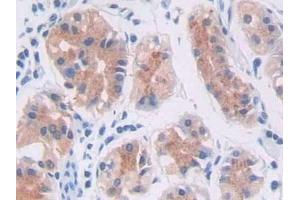 Immunohistochemistry (IHC) image for anti-phospholipase C, gamma 1 (PLCG1) (AA 1091-1290) antibody (ABIN7431485)
