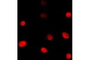 Immunofluorescent analysis of TBX1 staining in Jurkat cells. (T-Box 1 Antikörper  (C-Term))
