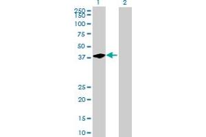 Western Blot analysis of BCL7C expression in transfected 293T cell line by BCL7C MaxPab polyclonal antibody. (BCL7C Antikörper  (AA 1-217))