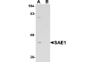 Western blot analysis of SAE1 in SK-N-SH lysate with SAE1 antibody at 1 µg/mL in (A) the absence and (B) the presence of blocking peptide. (SAE1 Antikörper  (C-Term))