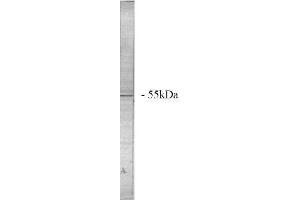 Image no. 1 for anti-Protein Phosphatase 2, Regulatory Subunit A, beta (PPP2R1B) (N-Term) antibody (ABIN264941) (PPP2R1B Antikörper  (N-Term))