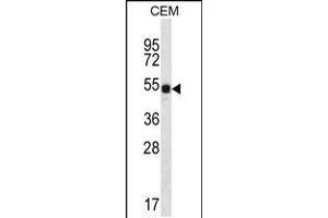 Western blot analysis in CEM cell line lysates (35ug/lane). (DAZ3 Antikörper  (C-Term))