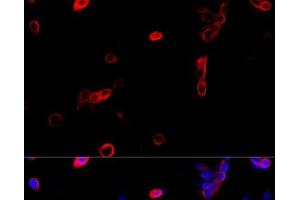 Immunofluorescence (IF) image for anti-ATP Synthase, H+ Transporting, Mitochondrial F1 Complex, beta Polypeptide (ATP5B) antibody (ABIN7010818)