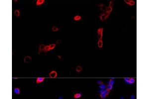 Immunofluorescence analysis of NIH/3T3 cells using ATP5B Polyclonal Antibody at dilution of 1:100 (40x lens).