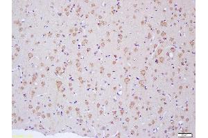 Formalin-fixed and paraffin embedded rat brain labeled with Anti-NF2/Neurofibromin 2 Polyclonal Antibody, Unconjugated  at 1:200 followed by conjugation to the secondary antibody and DAB staining (Merlin Antikörper  (AA 401-550))