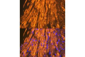 Immunofluorescence analysis of mouse heart using  Rabbit mAb (ABIN7265397) at dilution of 1:100 (40x lens). (ACTN2 Antikörper)