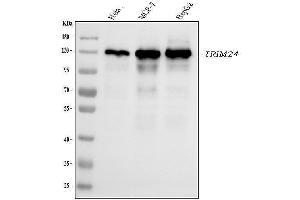 Western blot analysis of TRIM24 using anti-TRIM24 antibody (ABIN7602358).