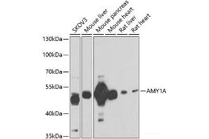 Western blot analysis of extracts of various cell lines using AMY1A Polyclonal Antibody at dilution of 1:1000. (AMY1A Antikörper)