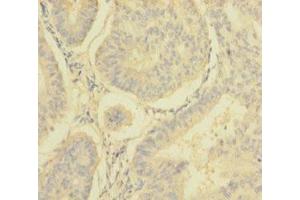 Immunohistochemistry (IHC) image for anti-NADH Dehydrogenase (Ubiquinone) 1 alpha Subcomplex, 6, 14kDa (NDUFA6) (AA 27-154) antibody (ABIN7160909)