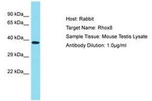 Image no. 1 for anti-Reproductive Homeobox 8 (RHOX8) (AA 180-229) antibody (ABIN6750292) (RHOX8 Antikörper  (AA 180-229))