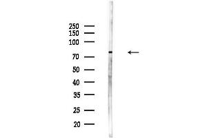 anti-MAP/microtubule Affinity-Regulating Kinase 2 (MARK2) (Internal Region) antibody