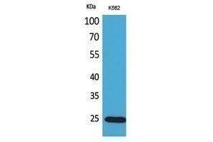 Western Blotting (WB) image for anti-Insulin-Like Growth Factor Binding Protein 6 (IGFBP6) (Internal Region) antibody (ABIN6280733)