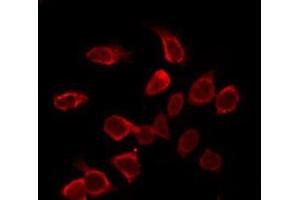 ABIN6275396 staining NIH-3T3 by IF/ICC. (Prosaposin Antikörper  (Internal Region))