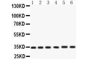 Western Blotting (WB) image for anti-Cyclin-Dependent Kinase 4 (CDK4) (AA 201-303) antibody (ABIN3043745) (CDK4 Antikörper  (AA 201-303))
