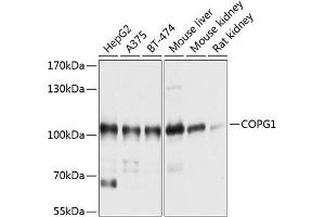 Western blot analysis of extracts of various cell lines, using COPG1 antibody (ABIN6129672, ABIN6138875, ABIN6138876 and ABIN6214841) at 1:1000 dilution.