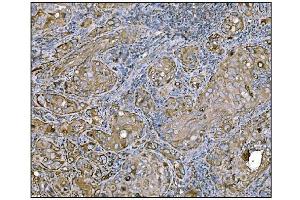IHC analysis of HCCS using anti-HCCS antibody (ABIN7602424). (HCCS Antikörper  (AA 76-268))