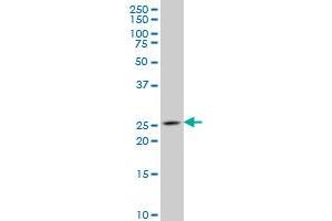Western Blotting (WB) image for anti-NK3 Homeobox 1 (NKX3-1) (AA 100-209) antibody (ABIN518368)