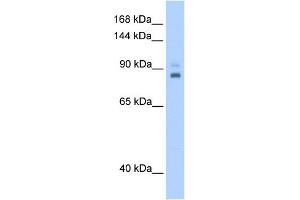 WB Suggested Anti-TPX2 Antibody Titration:  0. (TPX2 Antikörper  (C-Term))