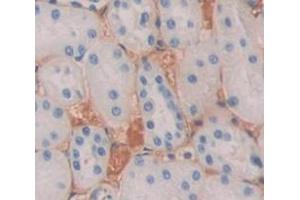Used in DAB staining on fromalin fixed paraffin- embedded Kidney tissue (SEMA4D/CD100 Antikörper  (AA 145-494))