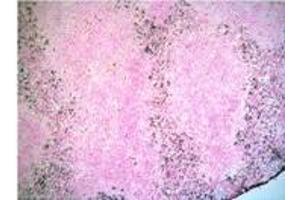 anti-Neutrophil antibody