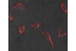 Immunofluorescence analysis of Nestin antibody and HeLa cells. (Nestin Antikörper  (AA 1560-1590))